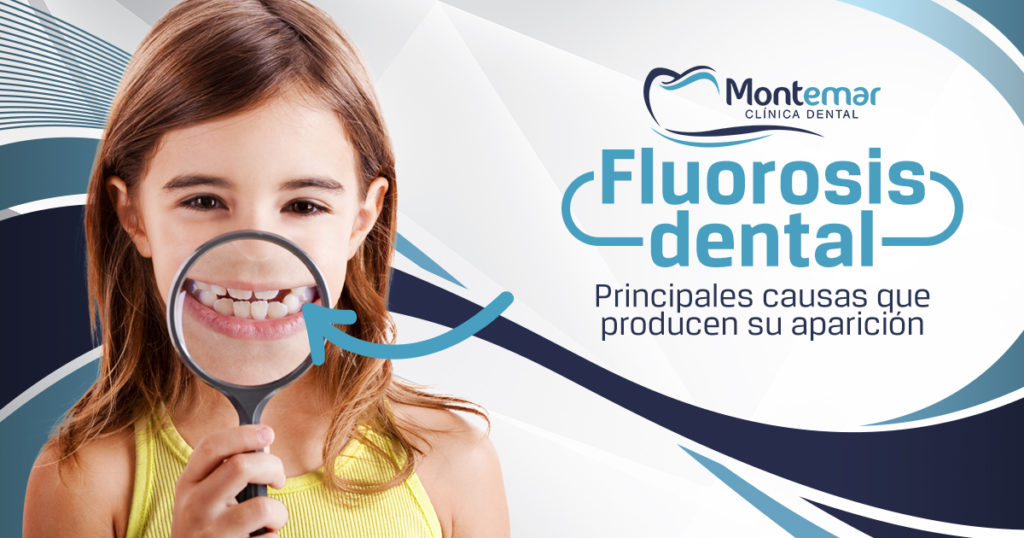 Fluorosis Dental: La Cara B Del Exceso De Flúor Sobre Tus Dientes